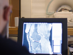 rmv-rättsmedicin-bild från magnetkamera på knäled