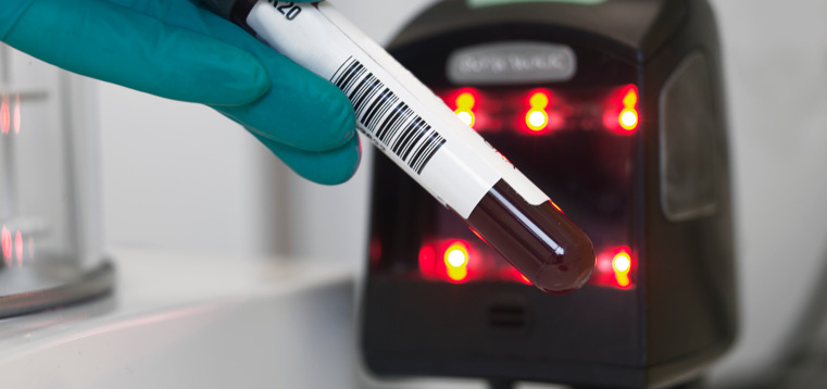 Scanner som läser av blodprov