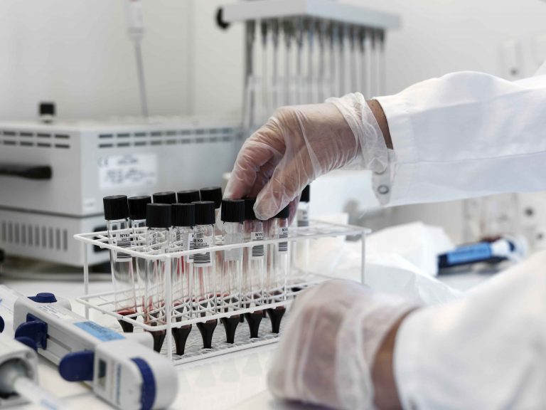 Analys av blodprov på rättskemi vid bland annat drogtester och alkoholanalyser.