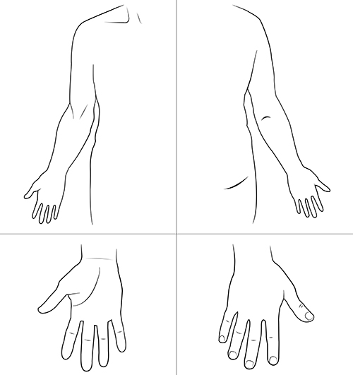 Kroppsskiss över höger arm och hand
