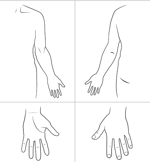 Kroppsskiss över vänster hand och arm